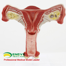 SELL 12443 Model Uterus Show Feminino Estruturas Genitais Modelo de Anatomia Uterina